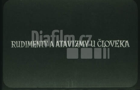 Rudimenty a atavismy u člověka